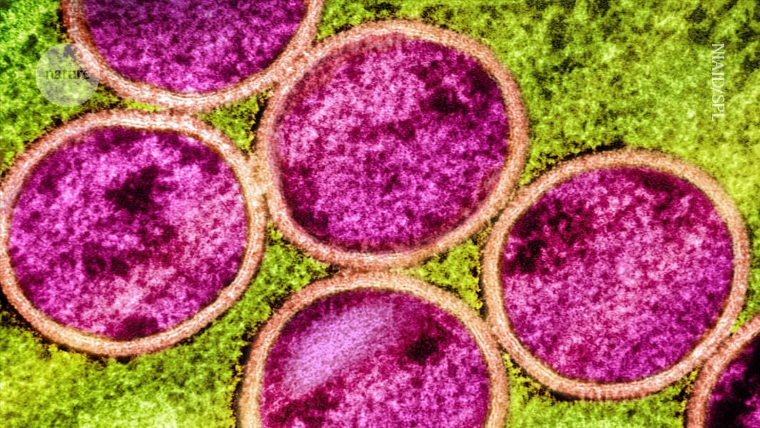 Will mpox go global again? Research shows it's evolving in curious ways - Nature