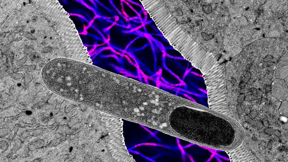 One Gut Microbe Blocks Weight Gain in Mice on a High-Fat Diet - ScienceAlert